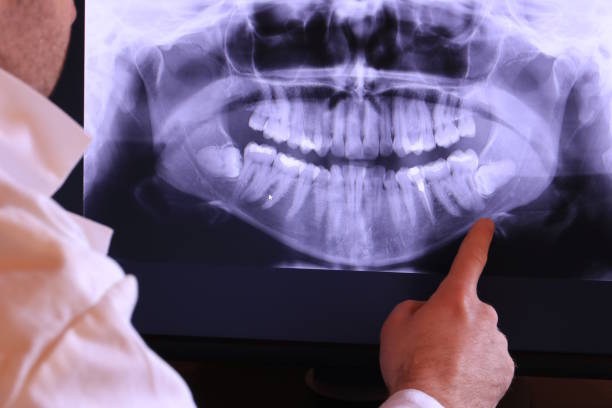Best Emergency Denture Repair in Alexandria, MN
